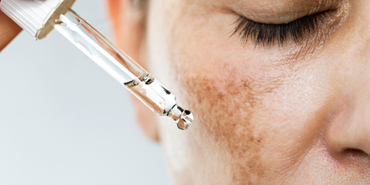 Hyperpigmentation in Menopause? You need Retinol & Niacinamide